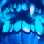 Frost Bite
